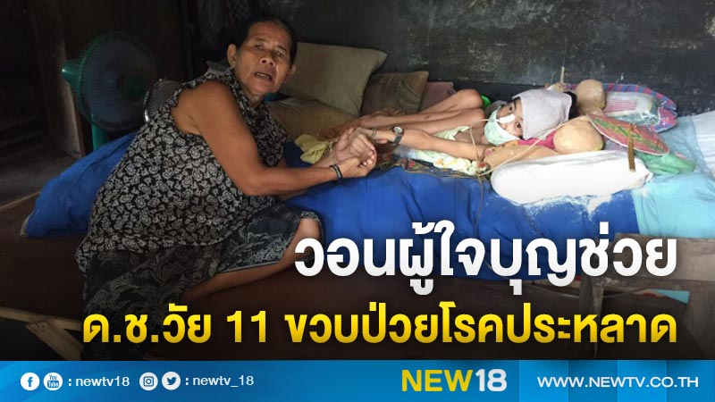 วอนผู้ใจบุญช่วย ด.ช.วัย 11 ขวบป่วยโรคประหลาด