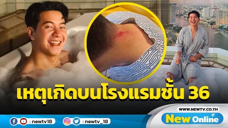 ดีที่หัวไม่ฟาด ! “ไอซ์ ศรัณยู” แชร์ประสบการณ์ประมาท หงายหลังคอกระแทกบนโรงแรมชั้น 36 (มีคลิป)