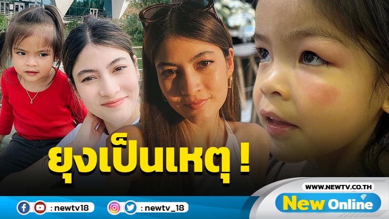 เอ็นดู “มาร์กี้” เผยภาพ “น้องมีญ่า” หน้า-ตาบวมตุ่ย แซวเบาๆ ไปต่อยกับใครมาลูก ?