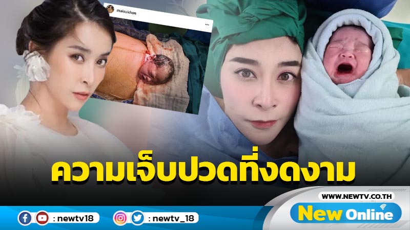 ตื้นตัน “ใหม่” เปิดภาพแรกคลอด “น้องชีต้าร์” ความเจ็บปวดที่แสนงดงาม