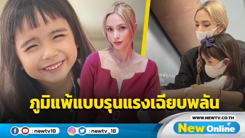 งดยาวๆ “อุ้ม” เผยสิ่งที่ “น้องดิสนีย์” แพ้แบบรุนแรงเฉียบพลัน !