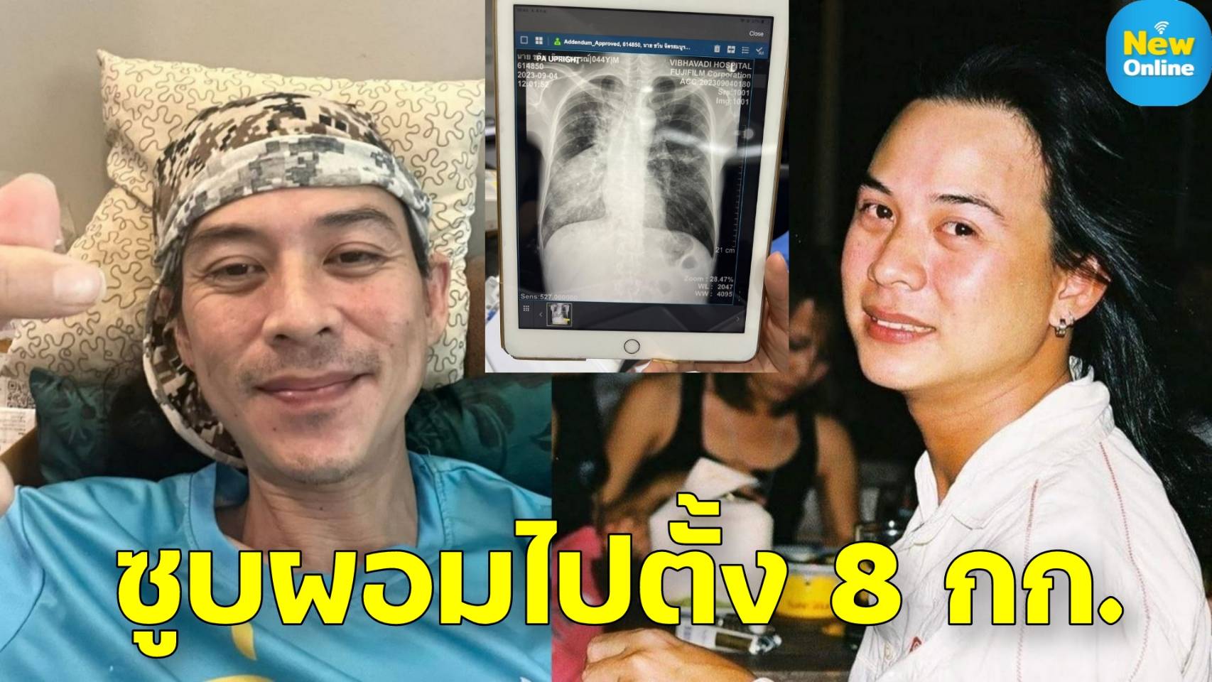 น้ำหนักลดฮวบ !! "จั๊ก ชวิน" อัพเดตอาการหลังติดวัณโรคจากเพื่อน