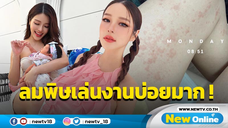 “แอร์ ภัณฑิลา” ภูมิตก ?! หลังคลอด ลมพิษเล่นงานบ่อยมาก