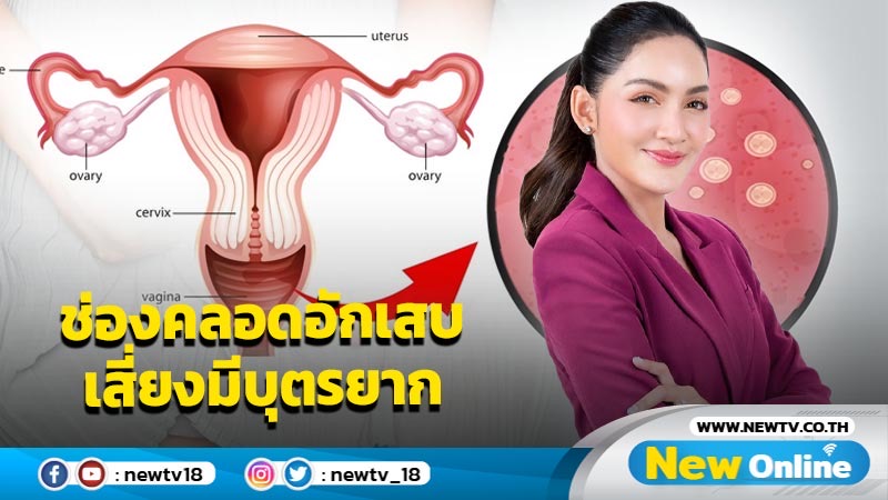 “โพรไบโอติกส์” ในช่องคลอดขาดสมดุล เสี่ยงช่องคลอดอักเสบ มีบุตรยาก