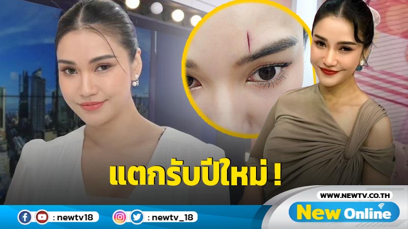 “ชมพู่ ก่อนบ่าย” ชนขอบประตูหน้าผากแตกเลือดซิบ ฟาดเคราะห์รับปีใหม่