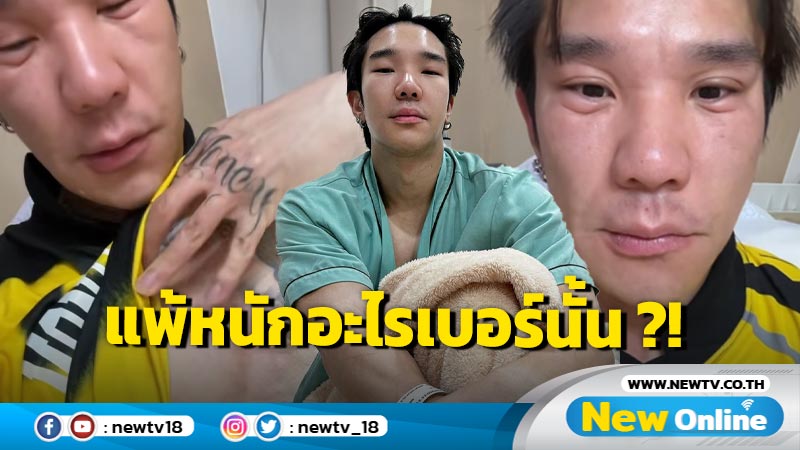 โอ้โห แพ้อะไรเบอร์นั้น ? “บอส ณัชพงษ์พล” เปิดภาพเกิดอาการแพ้หนักจนหน้าเปลี่ยน !