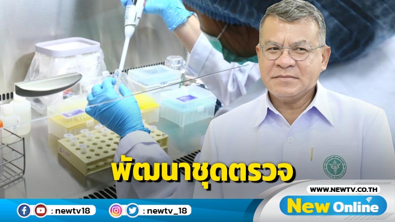 กรมวิทย์พัฒนาการตรวจเชื้อริกเก็ตเซีย 